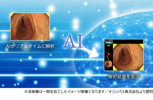 EndoBRAIN