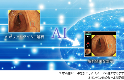 EndoBRAIN
